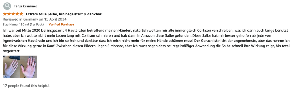 Мазь от псориаза отзывы