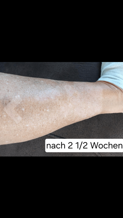 Sorion Repair Cream - мазь от псориаза