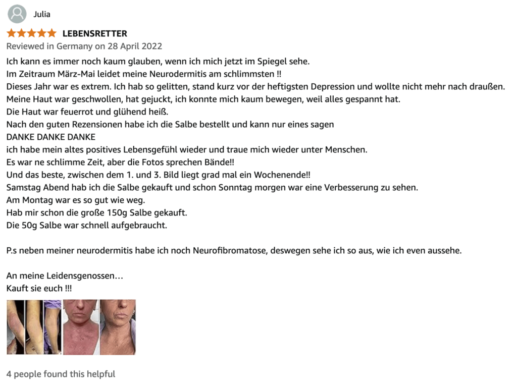 Sorion Repair Cream Sensitive - крем от псориаза