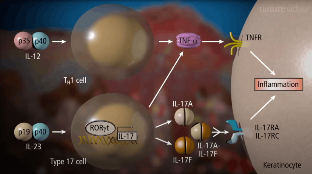 Суть псориаза